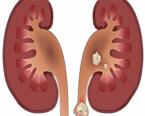 子宫壁薄做试管可以吗-子宫壁太薄做试管成功几率