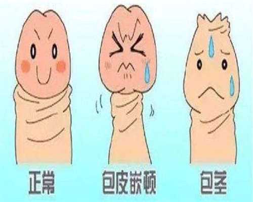 多囊卵巢综合征B超会出现的结果