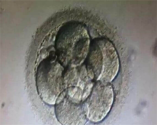 怎么判断北京助孕宝宝嗜睡