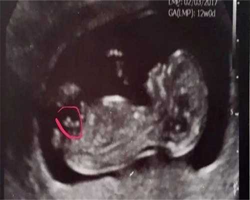 北京助孕宝宝防疫针打几次