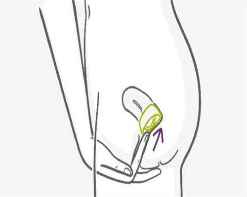 供卵试管生儿子,妇女不孕不育检查要怎么做，收费大概多少！