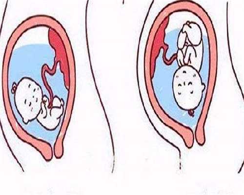 男性无精症做试管成功率高吗，无精症做供精试管的成功率和注意事项