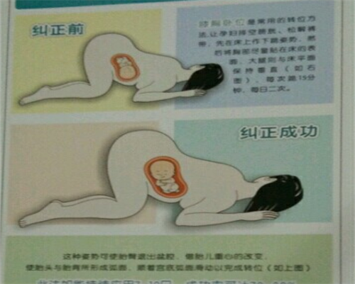 北京三代试管中介,北京赴美生子机构名单靠谱么