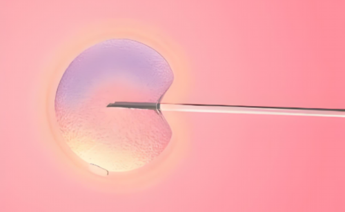 代生机构公司-多囊卵巢综合征表现什么