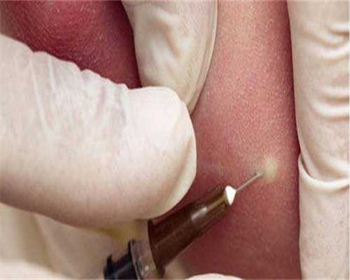 北京医院有捐卵吗,北京助孕-北京助孕机构-北京助孕机构