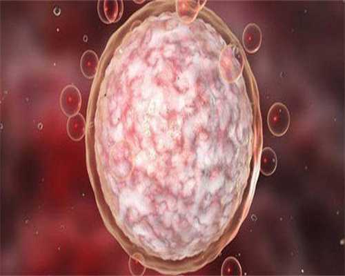 代生多胞胎-盆腔积液做试管成功率高吗？盆腔积液做试管婴儿的成功率高吗？