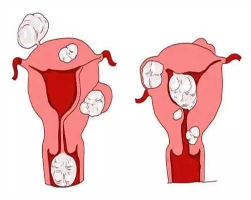 胚胎完全融合和半融合，胚胎完全融合和半融合的区别