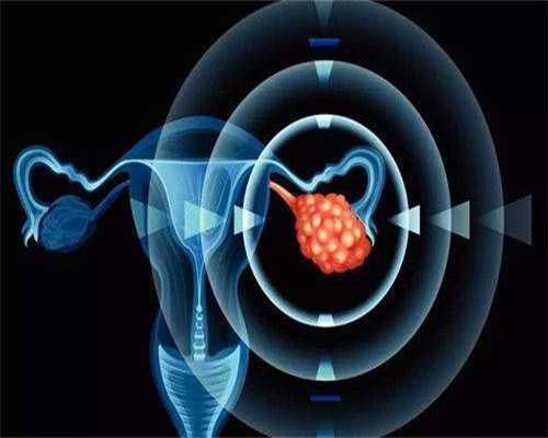 北京助孕代生大约多少钱(北京助孕代生多少钱一次)